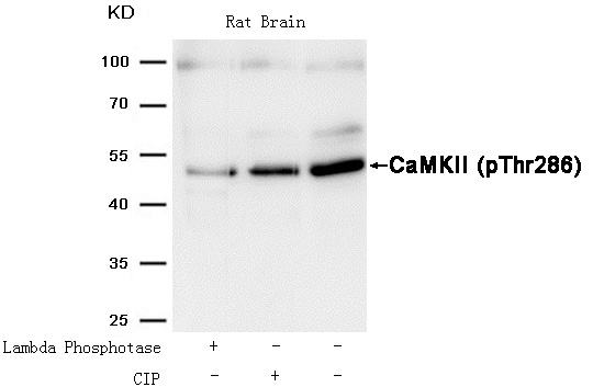 Rabbit Polyclonal Antibody to CaMKII(Phospho-Thr286)