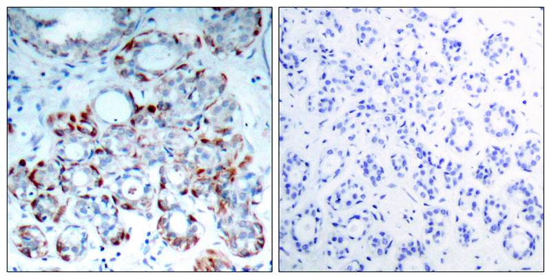Rabbit Polyclonal Antibody to BIM(Phospho-Ser69)