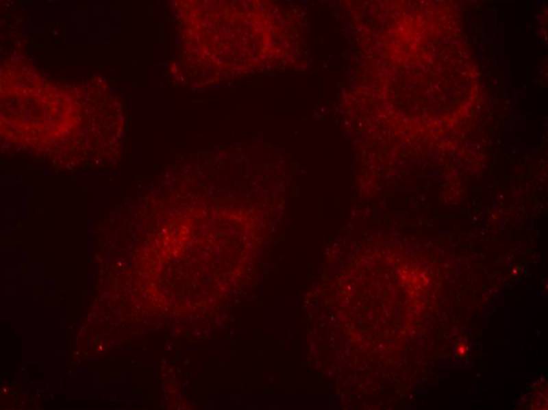 Rabbit Polyclonal Antibody to Gab1(Phospho-Tyr627)
