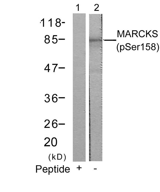 MARCKS(Phospho-Ser158)