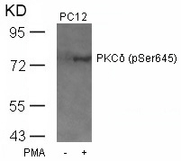 PKCd(Phospho-Ser645)