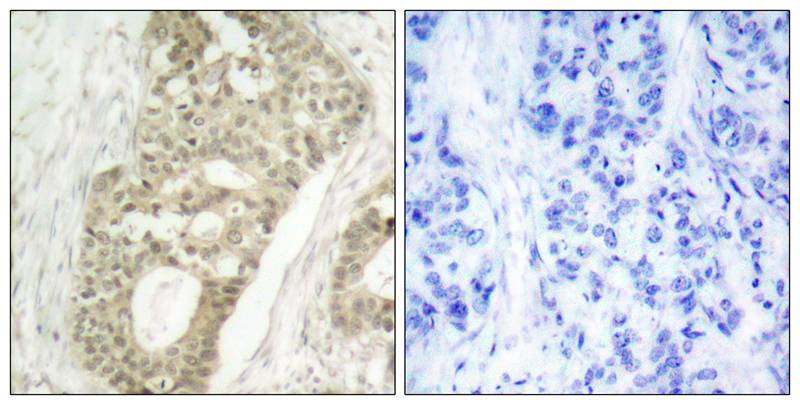 Rabbit Polyclonal Antibody to PKCd(Phospho-Ser645)
