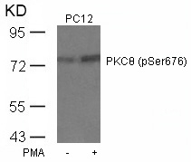 PKCth(Phospho-Ser676)
