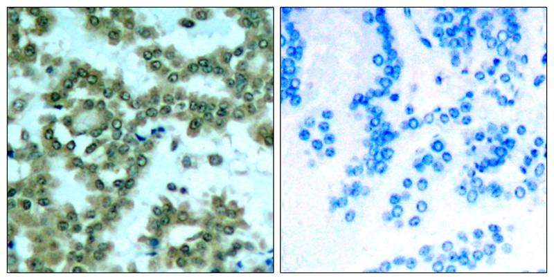 Rabbit Polyclonal Antibody to PKCth(Phospho-Ser676)