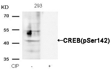 CREB(Phospho-Ser142)