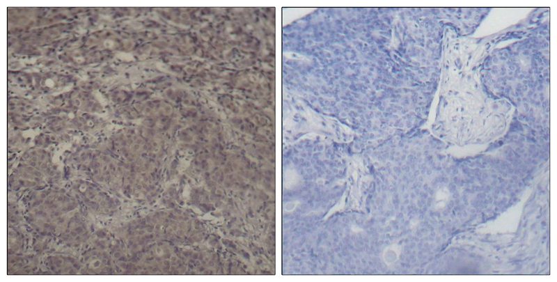 Rabbit Polyclonal Antibody to CREB(Phospho-Ser142)