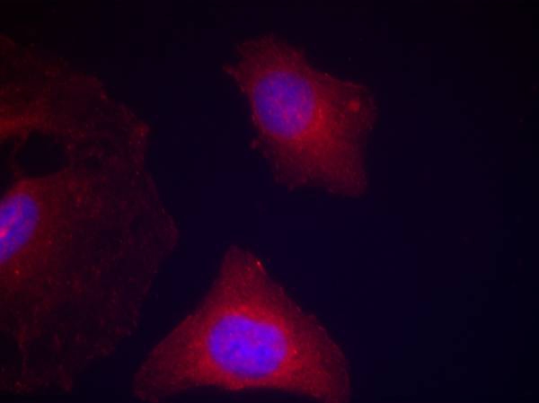 Rabbit Polyclonal Antibody to GSK3α/β(Phospho-Tyr279/216)