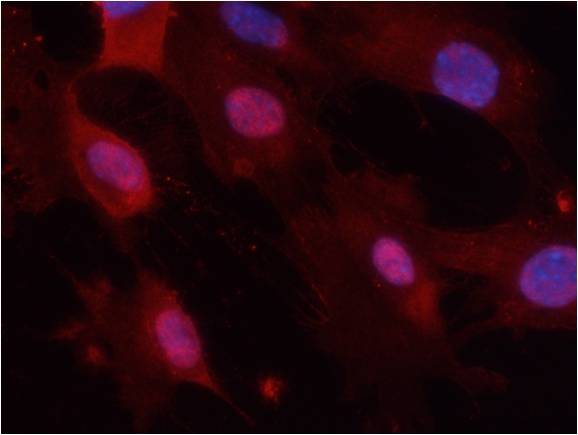 Rabbit Polyclonal Antibody to GSK3α/β(Phospho-Tyr279/216)