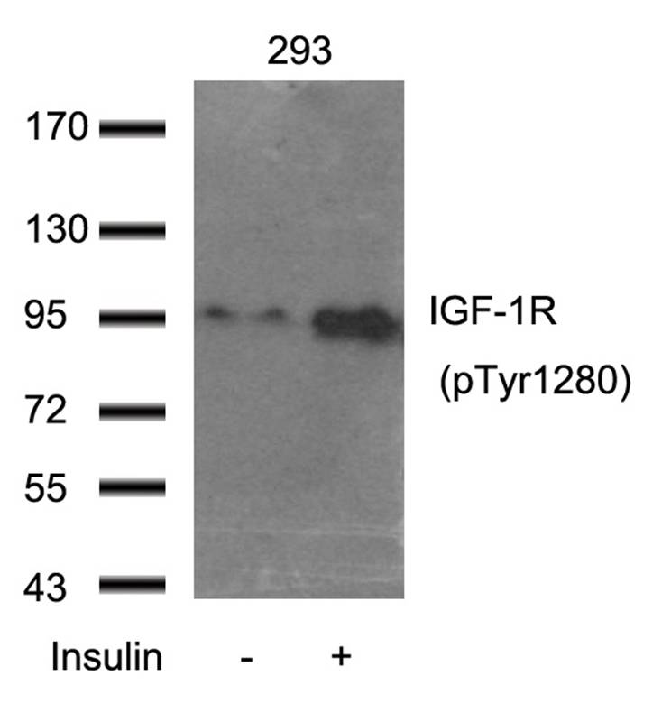 IGF-1R(Phospho-Tyr1280)