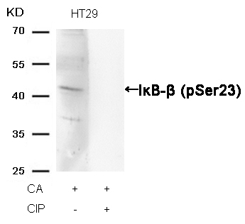 IkB-b(Phospho-Ser23)