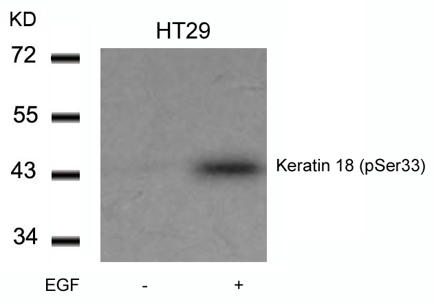 Keratin 18(Phospho-Ser33)