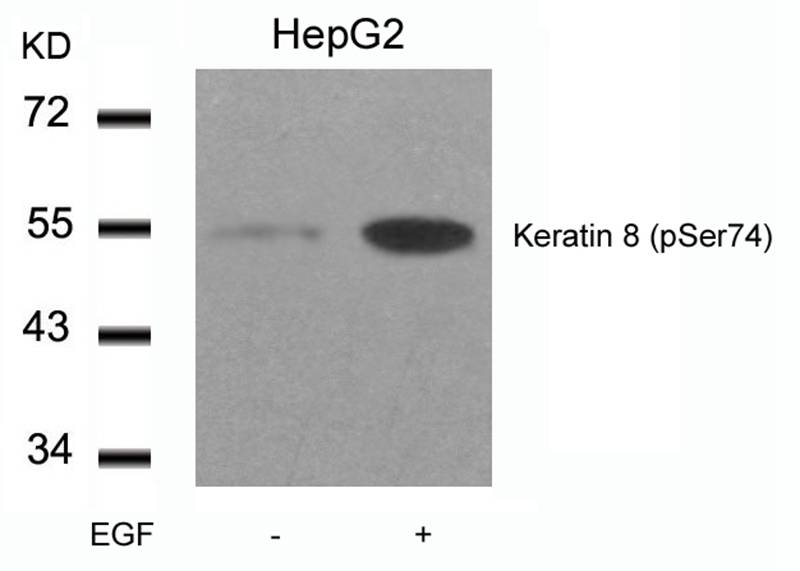 Keratin 8(Phospho-Ser74)