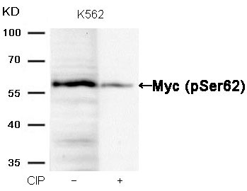 Myc(Phospho-Ser62)