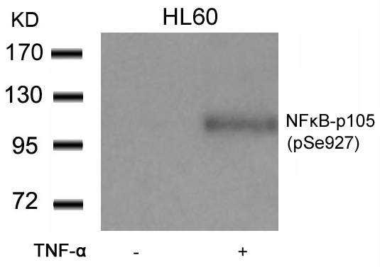 NFkB-p105(Phospho-Ser927)