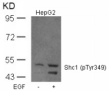 Shc1(Phospho-Tyr349)