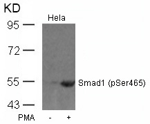 Smad1(Phospho-Ser465)