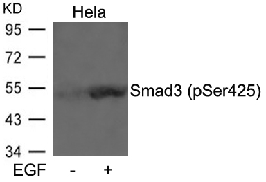 Smad3(Phospho-Ser425)