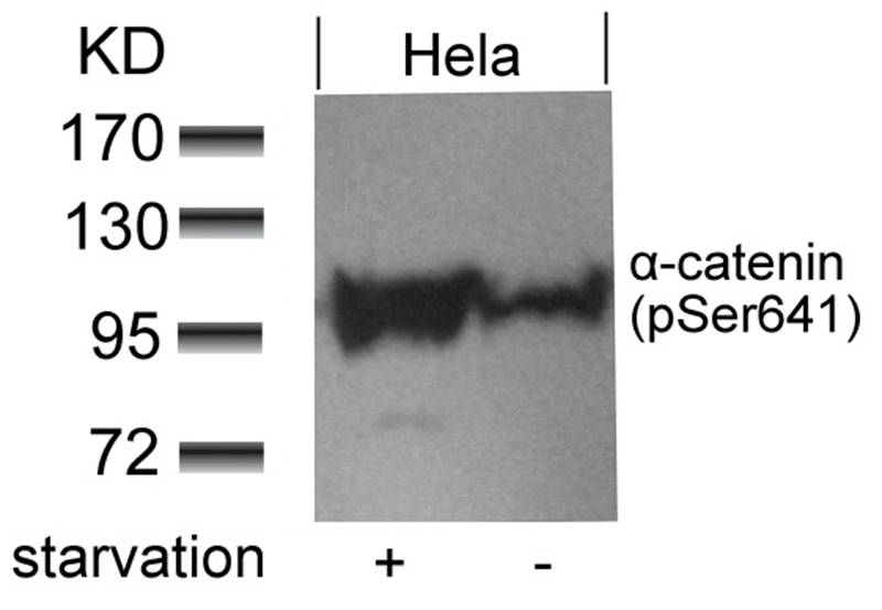 a-catenin(Phospho-Ser641)