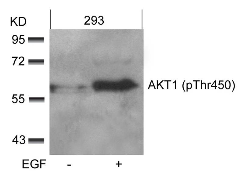 AKT1(phospho-Thr450)