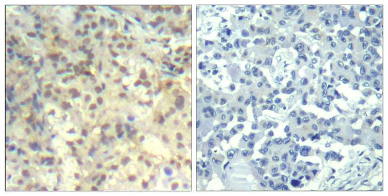 cofilin1(phospho-Tyr139)