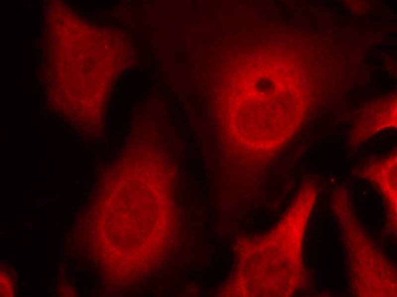 Rabbit Polyclonal Antibody to eIF2a(phospho-Ser49)