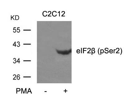 eIF2b(phospho-Ser2)