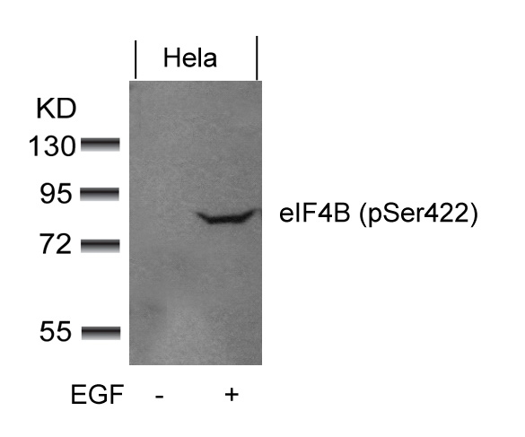 eIF4B(phospho-Ser422)