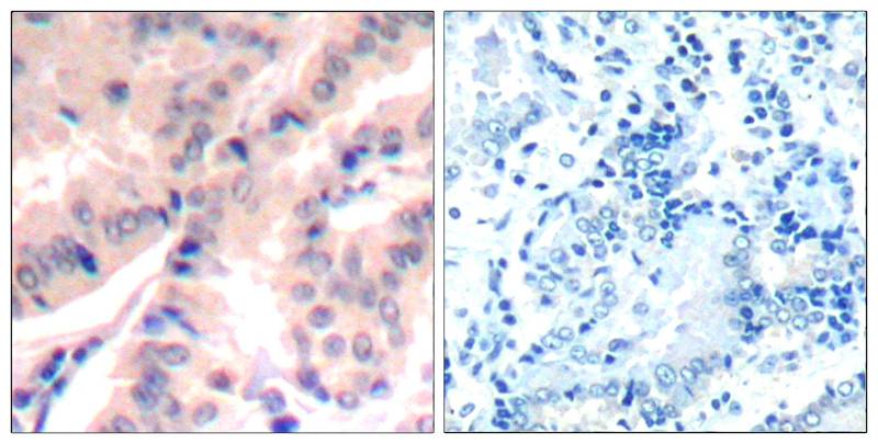Rabbit Polyclonal Antibody to eIF4B(phospho-Ser422)