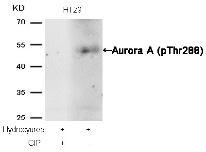 Aurora A(phospho-Thr288)