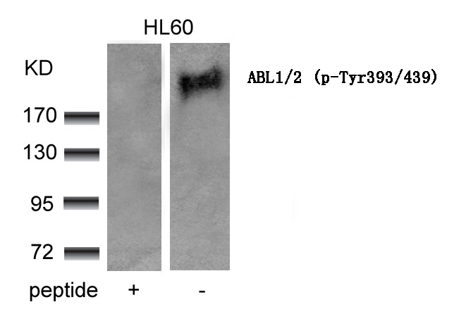 ABL1/2 (phospho-Tyr393/439)