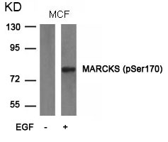MARCKS(phospho-Ser170)