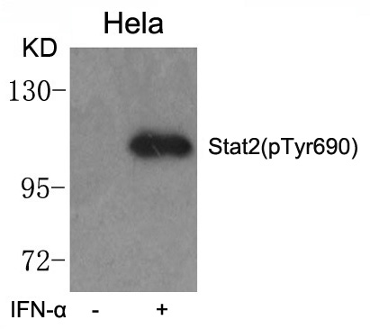 STAT2(phospho-Tyr690)