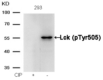 Rabbit Polyclonal Antibody to Lck(phospho-Tyr505)