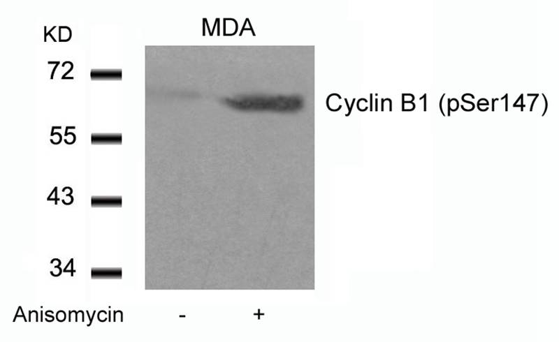 Cyclin B1(phospho-Ser147)