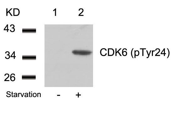 CDK6(phospho-Tyr24)