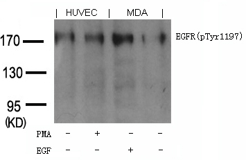 EGFR(phospho-Tyr1197) Goat