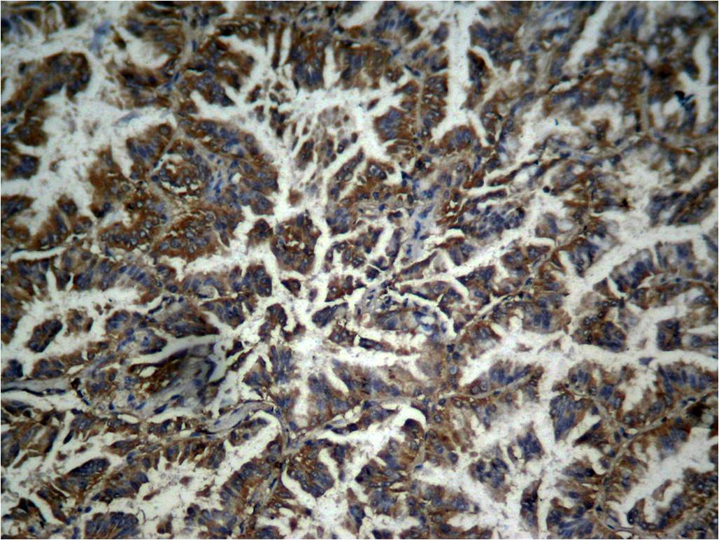 Rabbit Polyclonal Antibody to β-catenin(phospho-Tyr333)