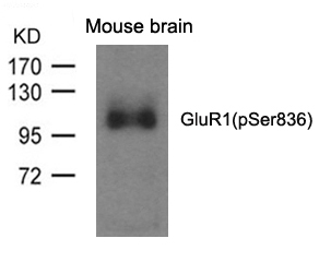 GluR1(phospho-Ser836)