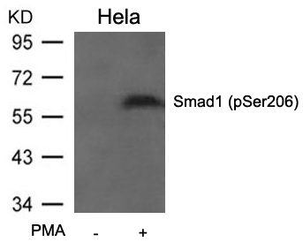 Smad1(Phospho-Ser206)
