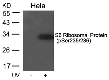 S6 Ribosomal Protein(Phospho-Ser235/236)