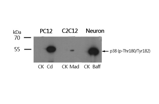 Rabbit Polyclonal Antibody to P38 MAPK(Phospho-Thr180/Tyr182)
