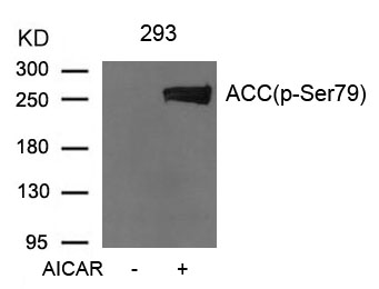 Acetyl-CoA Carboxylase (Phospho-Ser79)