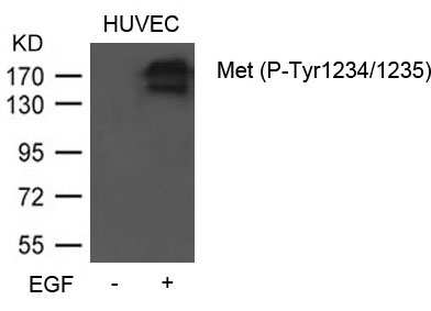Met (Phospho-Tyr1234/1235)