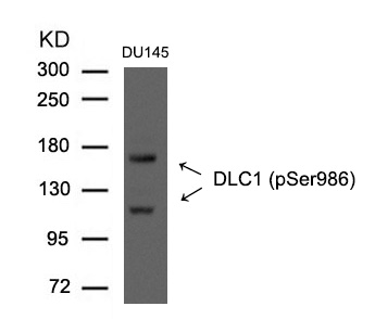DLC1 (Phospho-Ser986)