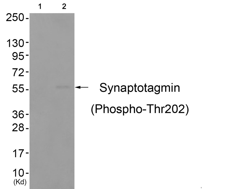Synaptotagmin (Phospho-Thr202)