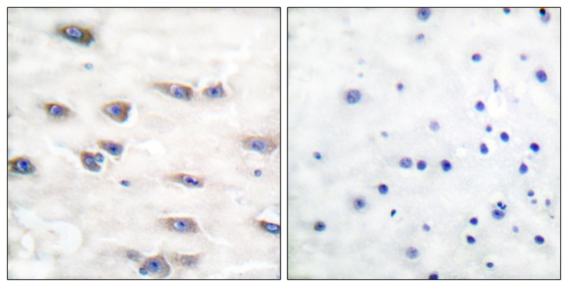 Trk A (Phospho-Tyr791)