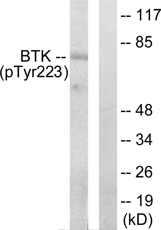BTK (Phospho-Tyr223)