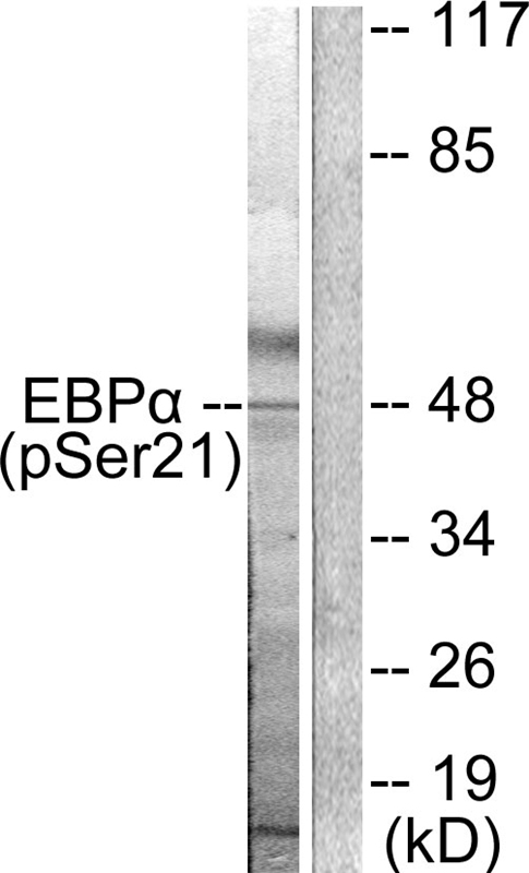 C/EBP-α (Phospho-Ser21)