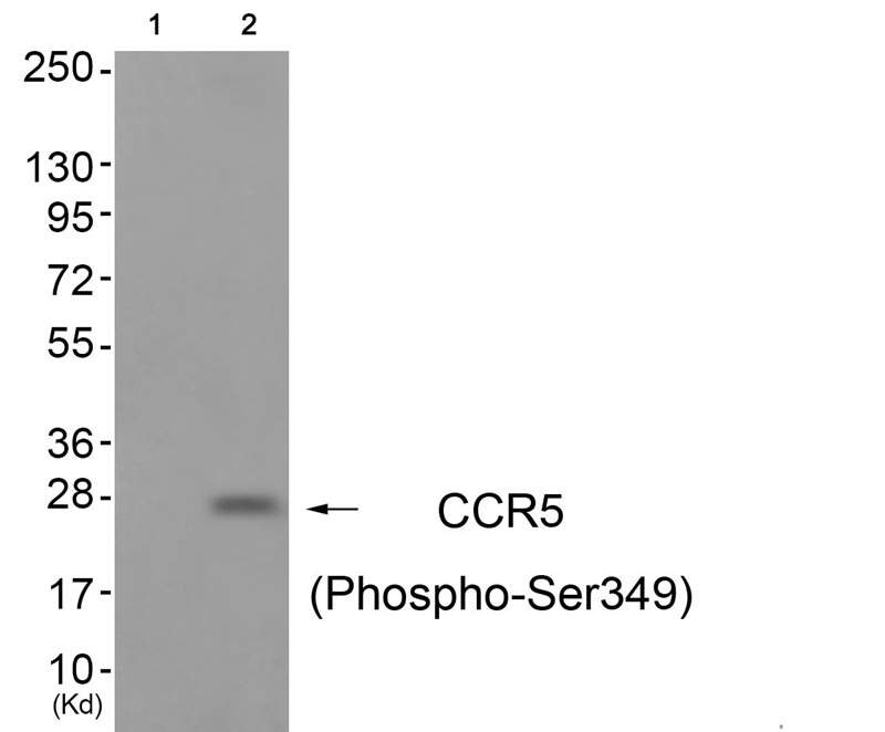 CCR5 (Phospho-Ser349)