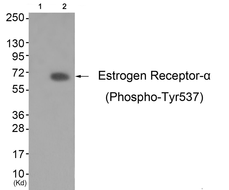 Estrogen Receptor-α (Phospho-Tyr537)
